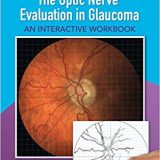 (eBook PDF)The Optic Nerve Evaluation in Glaucoma by Austin Lifferth
