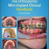 (eBook PDF)The Orthodontic Mini-Implant Clinical Handbook 2nd Edition by Richard Cousley