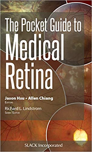 (eBook PDF)The Pocket Guide to Medical Retina by Jason Hsu