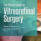 (eBook PDF)The Pocket Guide to Vitreoretinal Surgery by Jason N. Crosson