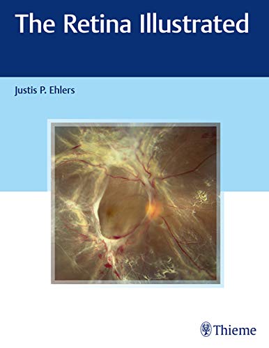 (eBook PDF)The Retina Illustrated by Justis P. Ehlers
