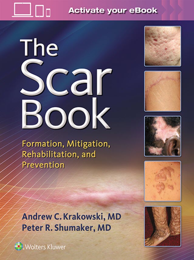 (eBook PDF)The Scar Book: Formation, Mitigation, Rehabilitation and Prevention - Original PDF by Dr. Andrew C. Krakowski , Dr. Peter R. Shumaker