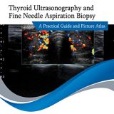 (eBook PDF)Thyroid Ultrasonography and Fine Needle Aspiration Biopsy by Samer El-Kaissi , Jack Wall