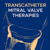 (eBook PDF)Transcatheter Mitral Valve Therapies by Ron Waksman , ToRogers , Ted Feldman