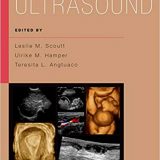 (eBook PDF)Ultrasound