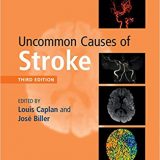 (eBook PDF)Uncommon Causes of Stroke 3rd Edition by Louis Caplan , José Biller