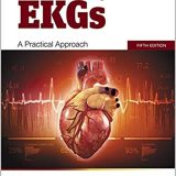 (eBook PDF)Understanding EKGs A Pratical Approach, 5th Edition  by Brenda M. Beasley