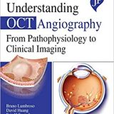 (eBook PDF)Understanding OCT Angiography From Pathophysiology to Clinical Imaging by Bruno Lumbroso , David Huang , Eric H Souied , Cristina Maria Savastano