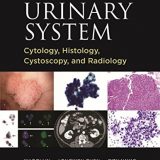 (eBook PDF)Urinary System Cytology, Histology, Cystoscopy, and Radiology by Xiaoqi Lin;Longwen Chen;Ritu Nayar , Linda H. Mehta