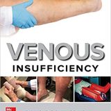 (eBook PDF)Venous Insufficiency by Raymond E. Phillips