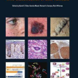 (eBook PDF)WHO Classification of Skin Tumours (Medicine) 4th Edition by WHO Classification of Tumours Editorial Board , D. Massi , R. Scolyer , R. Willemze
